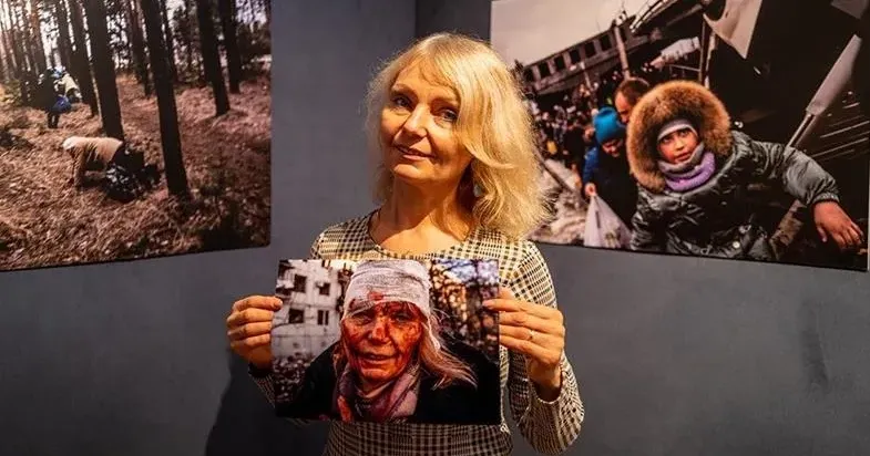 Її фото облетіло обкладинки світових ЗМІ — історія пораненої в перший день повномасштабної війни жительки Чугуєва